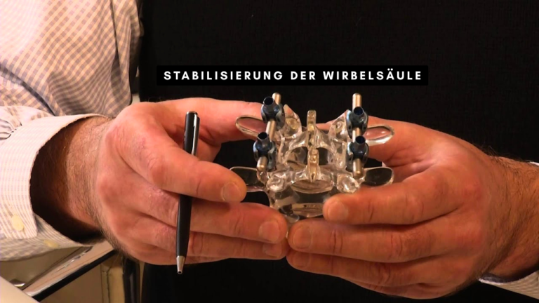 Stabilisierung der Wirbelsäule Ablauf Vorteile Risiken und Heilungsprozess duschkabine diana ersatzteile